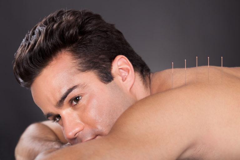 Chinese Medicine & Acupuncture for Stress