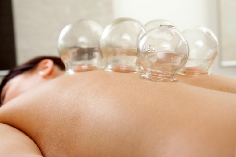 Acupuncture for Pain Relief in Melbourne